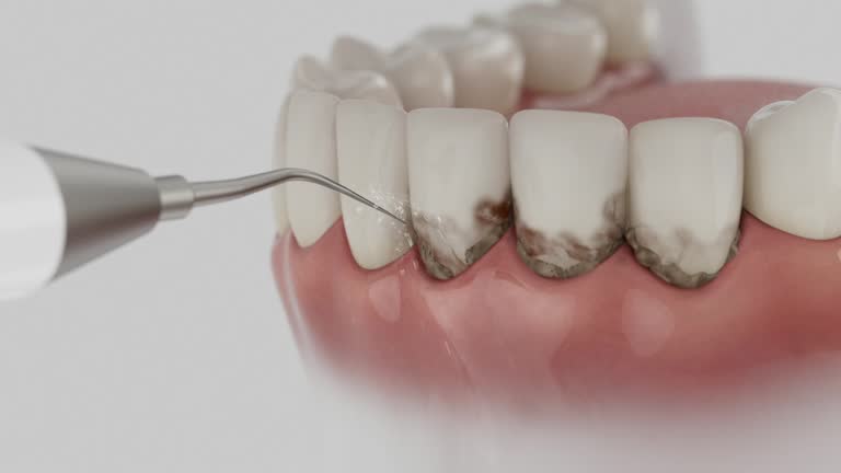 Reliable Dental Implants contractor in Prosper, TX by Smile Center Dentistry